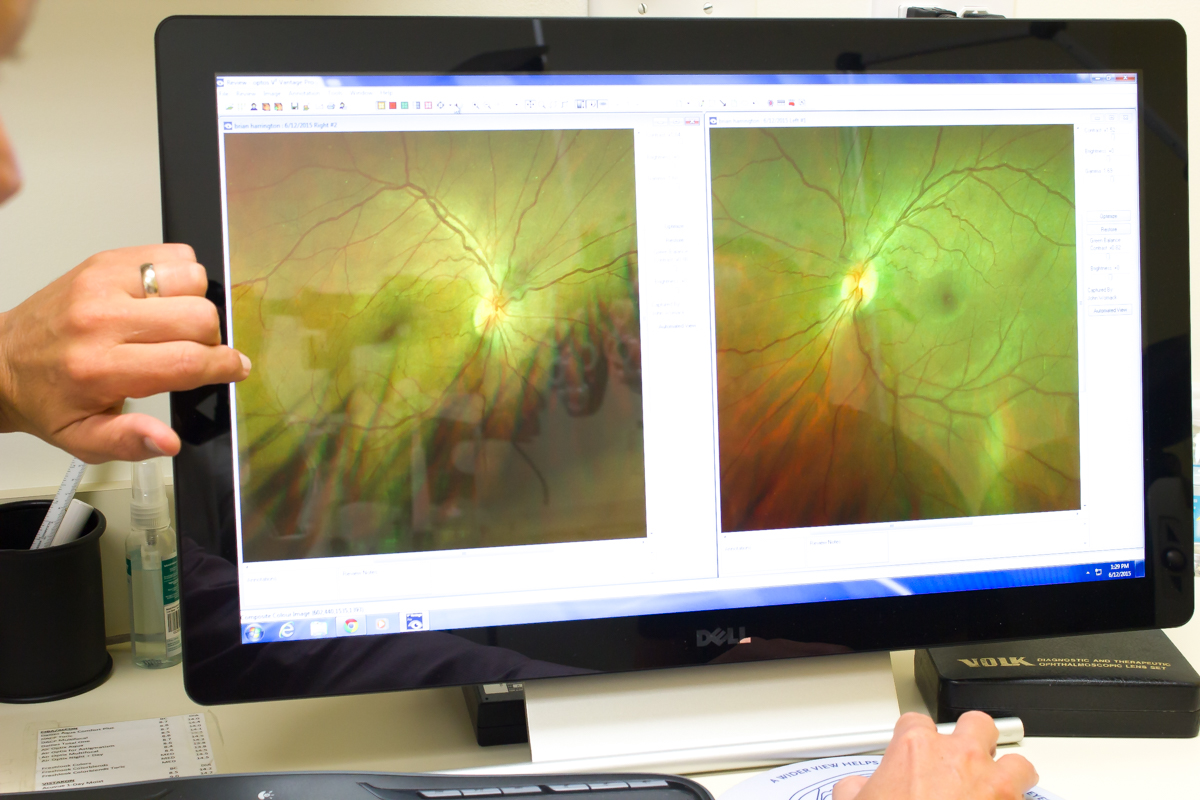 Retina digital exam image - Pearle Vision in Jacksonville Florida