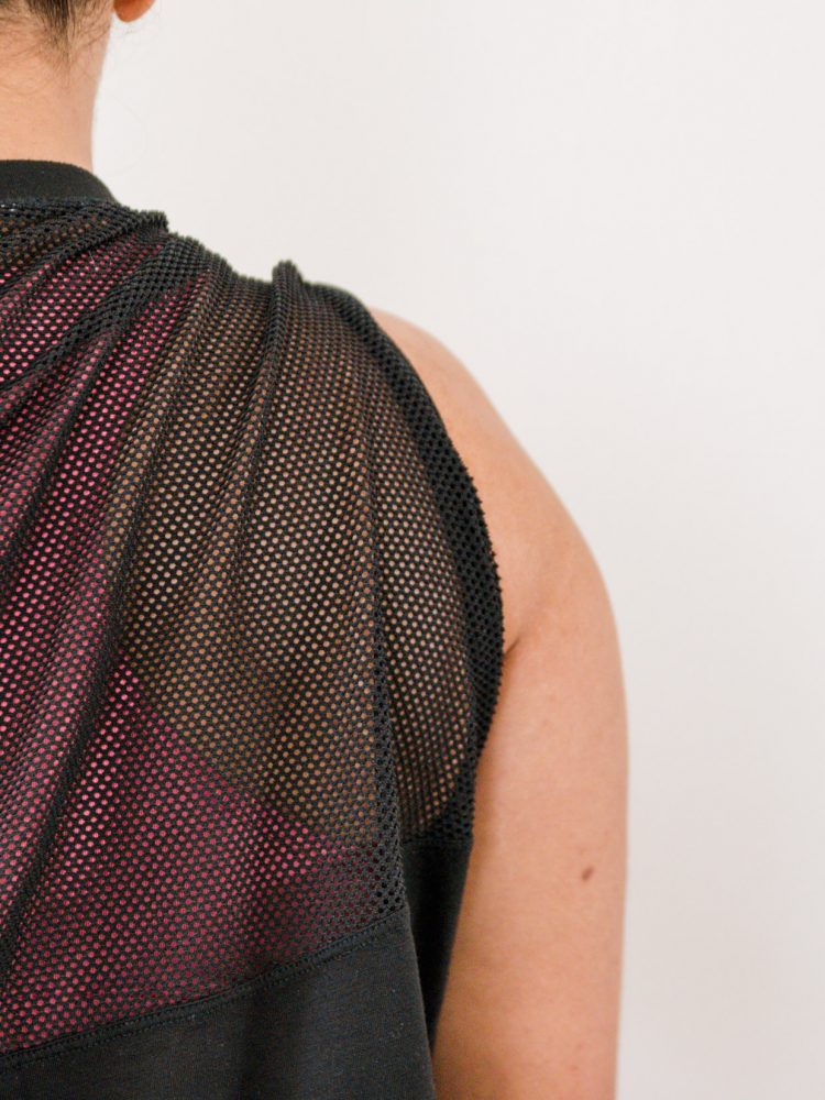 back of arm after cryoskin